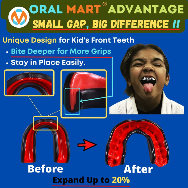 Oral Mart Sports Youth Mouth Guard for Kids (USA Flag & Vampire Fangs & 15 Colors) - Youth Mouthguard (BPA Free) MMA, Karate, Flag Football, Martial Arts, Rugby, Boxing, BJJ, Hockey (/w Vented Case) Youth (Age 12 & Below) Blue - BeesActive Australia
