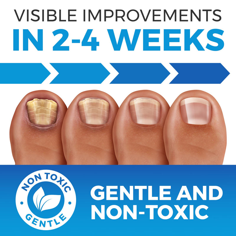 Anti Fungal Nail Treatment | Severe Fungal Nail Treatment for Toenails Extra Strong | Extra Large 75ML - BeesActive Australia