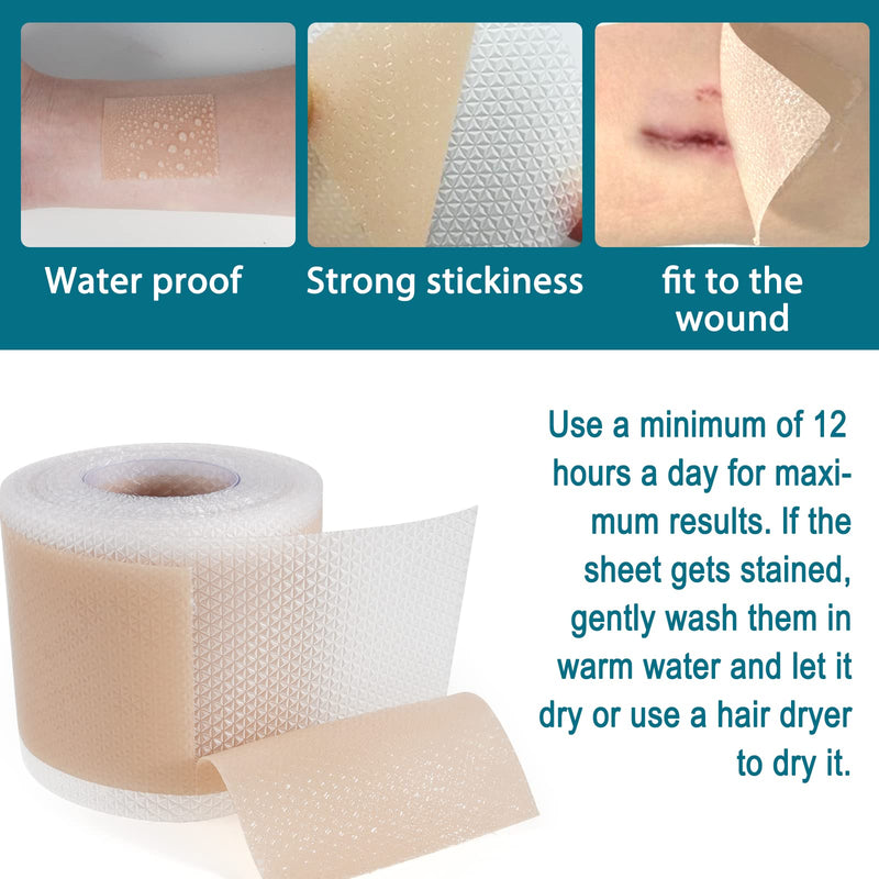 Silicone Scar Sheets (1.6” X 125”), Silicone Scar Tape Roll, Medical Grade Scar Removal Sheets for Keloid Scar Treatment, Old Scars, C-Section, Tummy Tuck, Reusable & Strong Adhesion, Waterproof One Size - BeesActive Australia