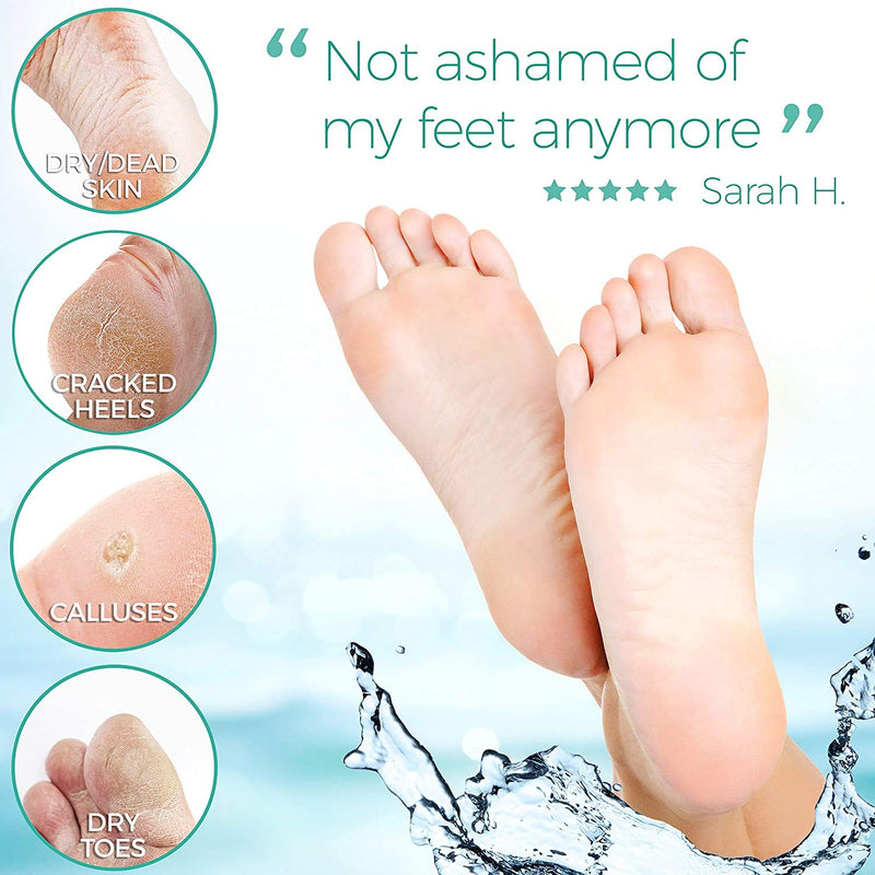 Foot Peel Mask - 2 Pack - For Cracked Heels, Dead Skin and Calluses - Make Your Feet Baby Soft Smooth Silky Skin - Removes Rough Heels, Dry Toe Skin Natural Treatment. (Rose Scent) - BeesActive Australia