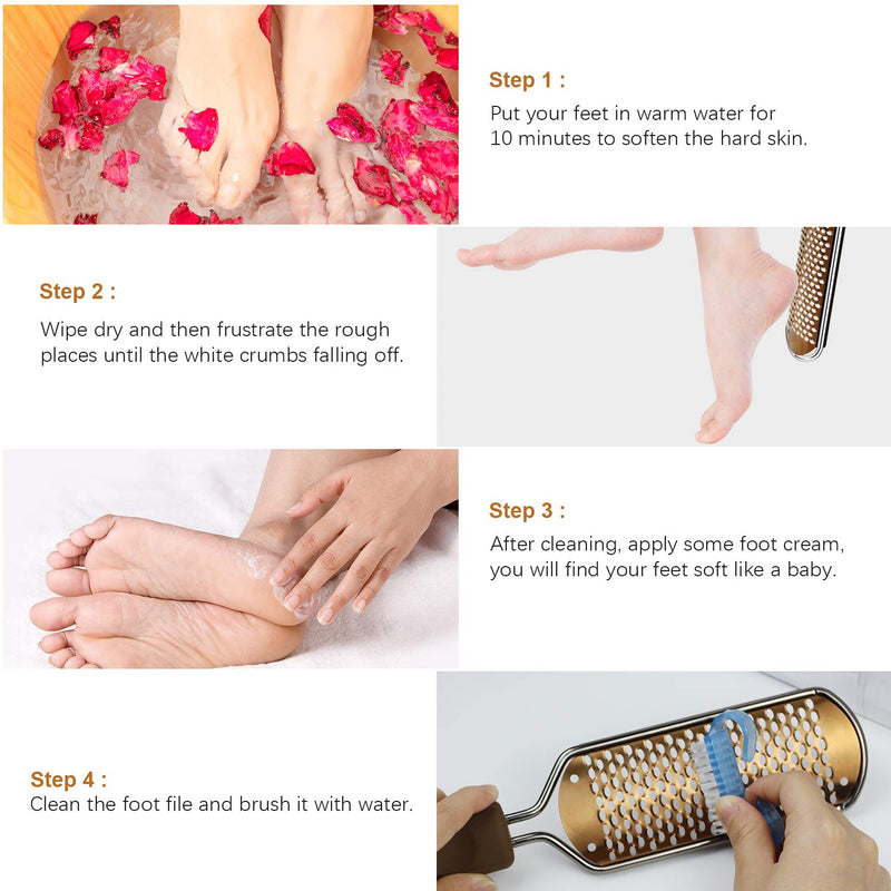 Pedicure Foot File Callus Remover - Large Foot Rasp Colossal Foot Scrubber Professional Stainless Steel Callus File for Wet and Dry Feet (Athens Copper) Athens Copper - BeesActive Australia