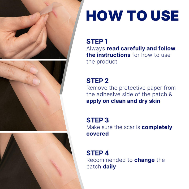 Elastoplast Scar Reducer Plasters (21 Patches), Quick and Convenient Scar Cover Up Treatment, Scar Sheets to Reduce Visibility of Scars, Scar Plaster Pack for Quick Results, Clear 21 Count (Pack of 1) - BeesActive Australia