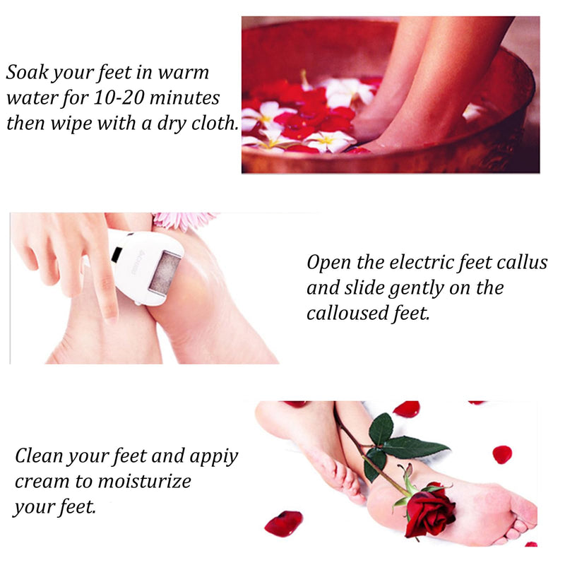 Foot Callus Remover, Professional Electric Pedicure Callus Remover, Rechargeable Foot File with 3 Roller Heads for Feet Care - BeesActive Australia