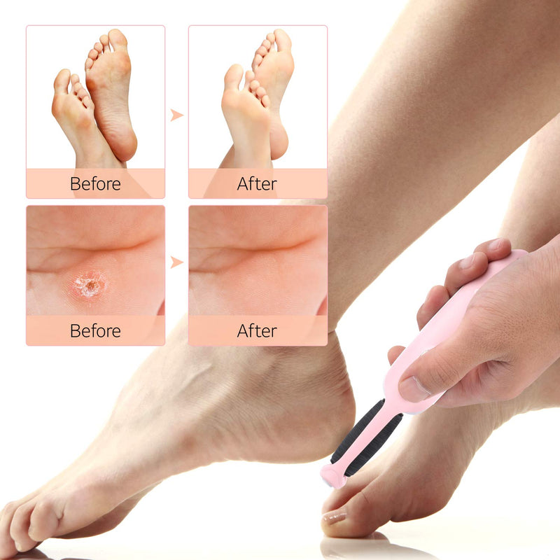 ABKO Electric Callus Remover Rechargeable Cordless Foot File Easy Grip Adjustable Power Pedi Feet Care for Dead Hard Skin Cracked Heels CR01 Pink - BeesActive Australia