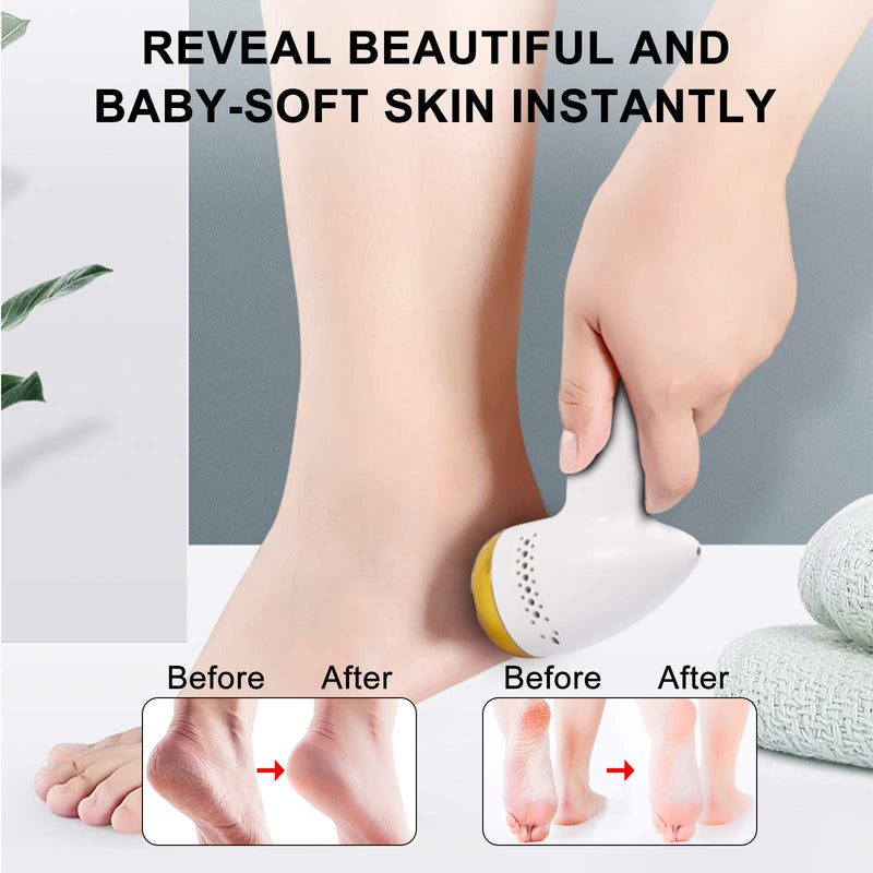 Electric Callus Remover, Lermende Electric Foot File USB Rechargeable Foot Pedicure Tools with 6pcs Grinding Heads Professional Foot Care Sander Best for Cracked Heels and Hard Skin - Gold - BeesActive Australia