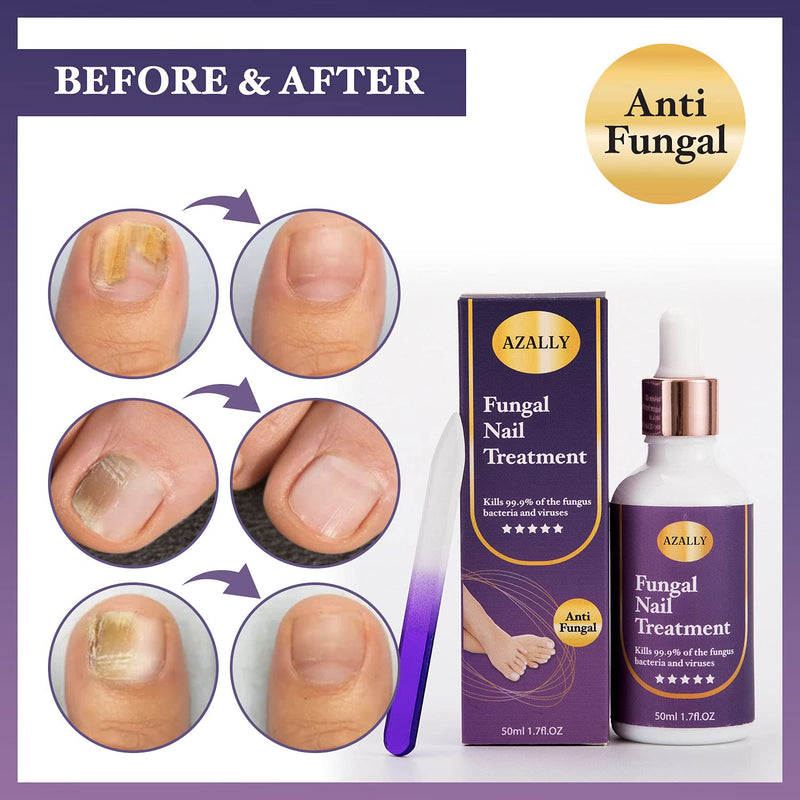 AZALLY Fungal Nail Treatment, Nail Fungus Treatment, Anti fungal Nail Solution— Kills Fungus on Toenails & Fingernails 50ml - BeesActive Australia