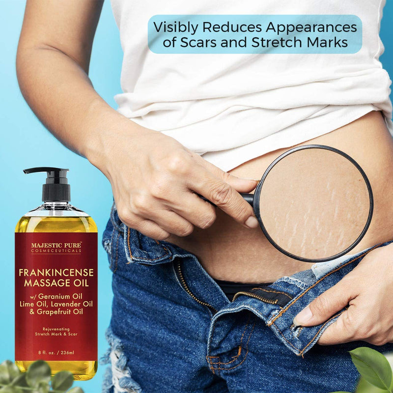 Stretch Mark and Scar Frankincense Massage Oil by Majestic Pure, for Softer & Smoother Skin - Visibly Reduces Appearances of Scars and Stretch Marks - 8 fl oz Frankincense Oil - BeesActive Australia