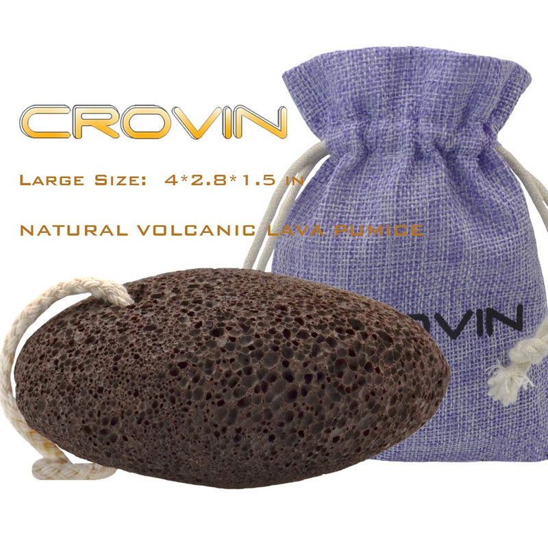 CROVIN Foot Pumice Stone for Feet Callus Remover - Natural Earth Lava Foot Scrubber Pack of 2 - Hypoallergenic Foot Peel in Foot Spa Quality - Pedicure Foot File - BeesActive Australia