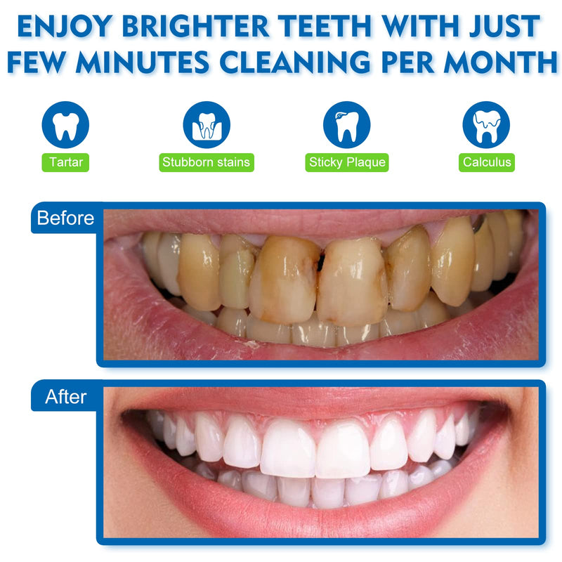Dental Cleaner kit Teeth Cleaning Kit with 5 Modes IPX6 Waterproof LED 4 Replaceable Cleaning Heads - BeesActive Australia