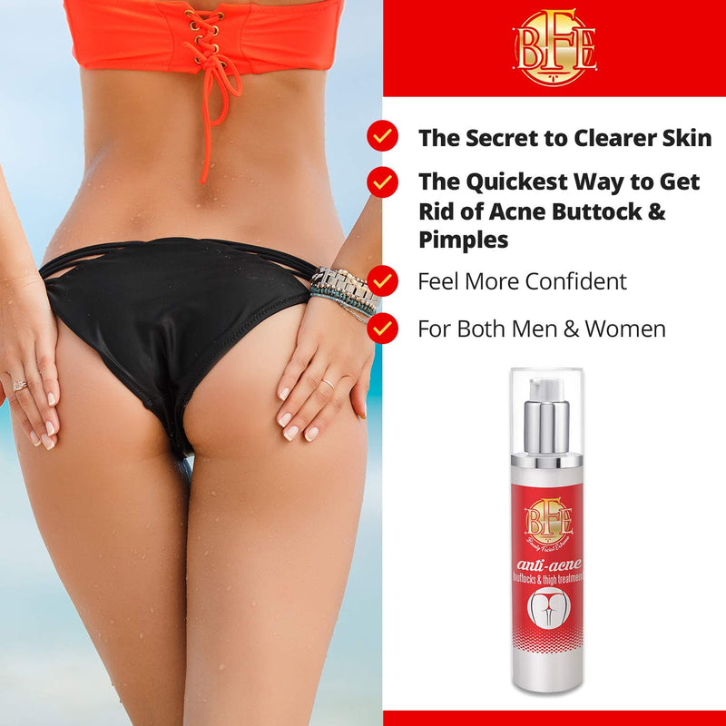 Anti-Acne Buttocks & Thigh Treatment- Clears Away Acne, Pimples, and Ingrown Hairs for the Buttocks and Thigh Area. Prevents Future Breakouts. - BeesActive Australia