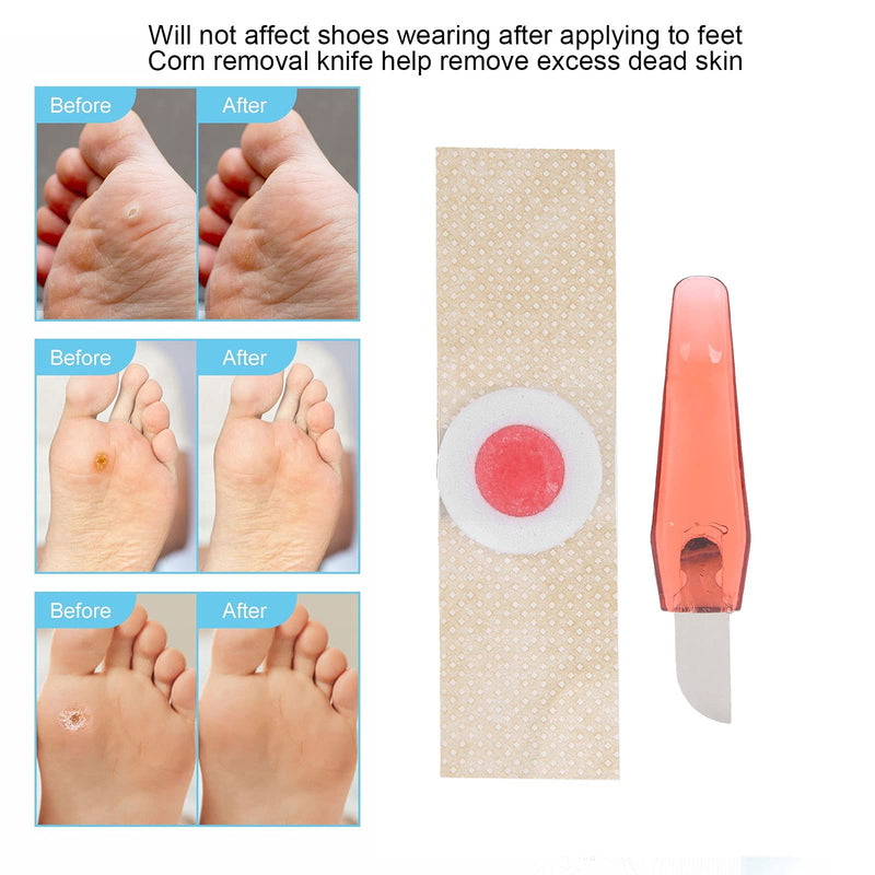Foot Corn Remover Pads, 18 Patch Toe Corn Callus Removal Pads stickers, Corn Remover Knife Set - BeesActive Australia