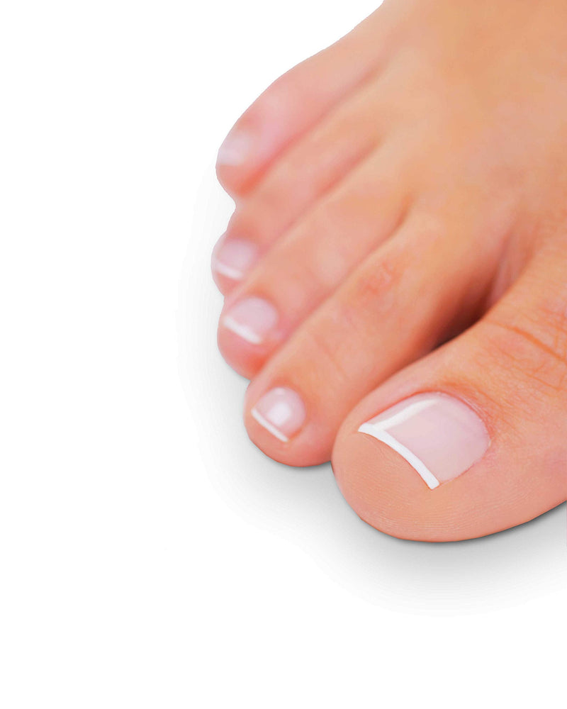 ProtectAir Fungal Nail Treatment - Extra Strong for toenails - 5ml + 5 Nail Files + Medical Shoe Spray - BeesActive Australia