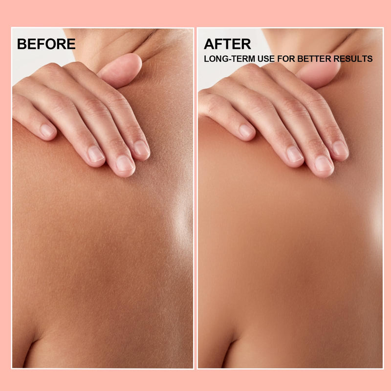 nbc BeautiLab -Oil Skincare Body Oil, Suitable for Scars and Stretch Marks and Improve the Appearance of neven Skin Tones, For All Skin Types，with Vitamin E -1.7oz - BeesActive Australia