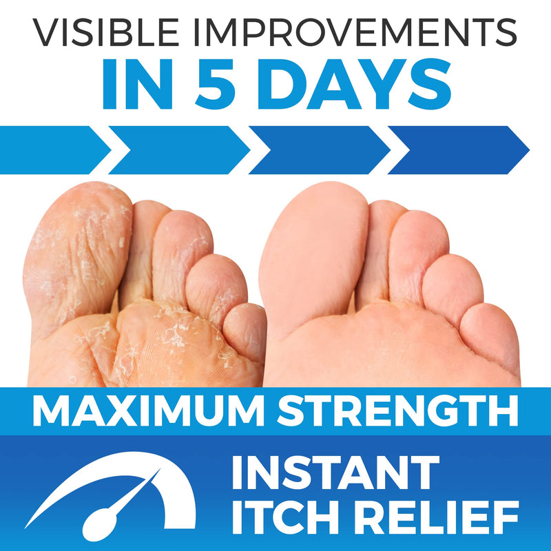 Extra Strong Athletes Foot Treatments Cream | Anti Itch Cream | Anti-Fungal Foot Treatment | Ringworm Foot Care | XL 75 ML - BeesActive Australia