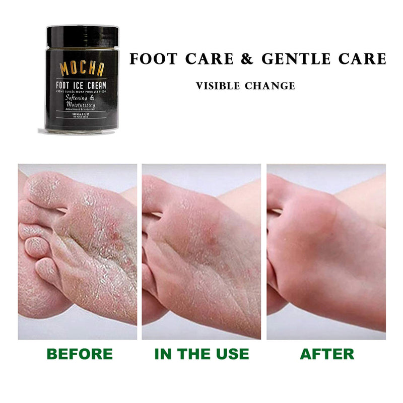 HIGH'S Foot Repair Cream, 5.4 Ounce Softening Foot Lotion Fast Relief for Dry Feet for Women Heel Lotion for Cracked Feet - BeesActive Australia