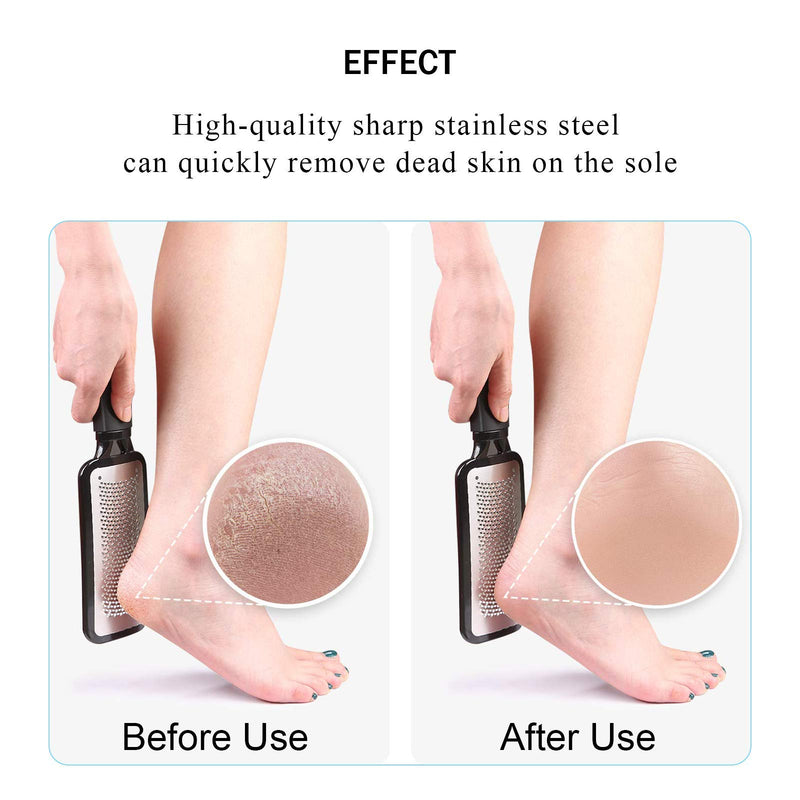 Foot File and Callus Remover, Colossal Foot Rasp Pedicure Metal Surface Tool to Remove Hard Skin, Can be Used on Both Wet and Dry Feet Black - BeesActive Australia