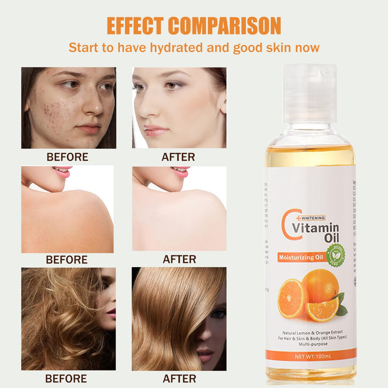 Vitamin C Oil, Massage Oils for Massage Therapy, Pain Relief Sensual Body Oil, Natural Massage Oils for Massage Therapy, Eyelashes, Hair, Eyebrows Growth, Moisturiser for Skin (Vitamin C) Vitamin C - BeesActive Australia