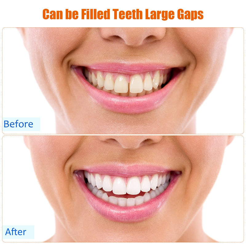 60 Pcs Temporary Tooth Repair Kit Moldable Fake Teeth and 50g Thermal Beads, Multi Use False Teeth Dental Tooth Replacement Do it Yourself Filling Tooth Bead for Fix Missing Broken Tooth Veneer - BeesActive Australia