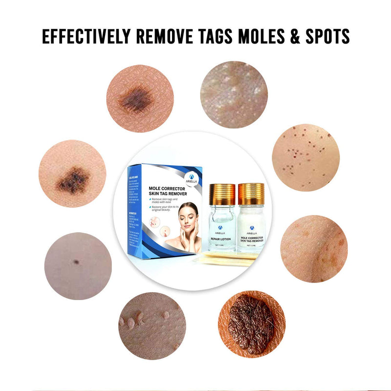 Ariella Removal Treatment-Made of Natural Plant Extracts-Simple and Easy to Apply Skin Tag Remover & Mole Corrector and Repair Lotion Set, - BeesActive Australia