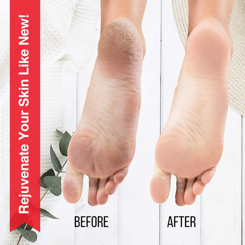 Foot Soaking Bath Spa - Includes 2 Callus Removers - For Soaking Feet | Great For Pedicures, Massaging, Relaxing, Essential Oils | For Removing Callus, Dead or Hard Skin | Great For At Home Spa - BeesActive Australia