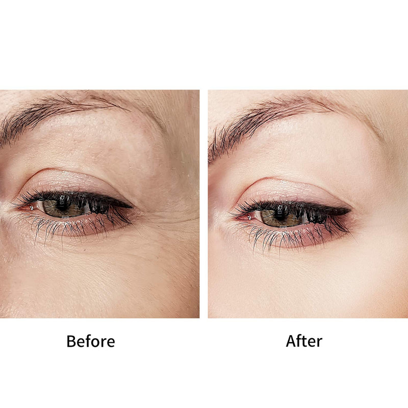 D.obsessed Retinol Eye Cream - Anti-aging Solution to Wrinkles, Crow's Feet, Dark Circles & Puffiness - Exclusive Formula of Retinol, Vitamin E, Hyaluronic Acid & Peptide (20g) - BeesActive Australia