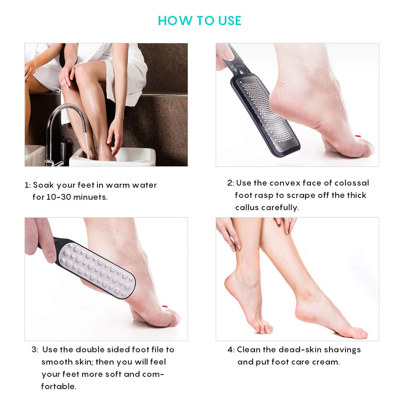 Foot Scrubber Pedicure Tools Rasp - 5 PCS KENED Foot File Callus Remover For Feet To Remove Hard Skin - 2 X Stainless Steel Black, 3 X Plastic White Black+White - BeesActive Australia