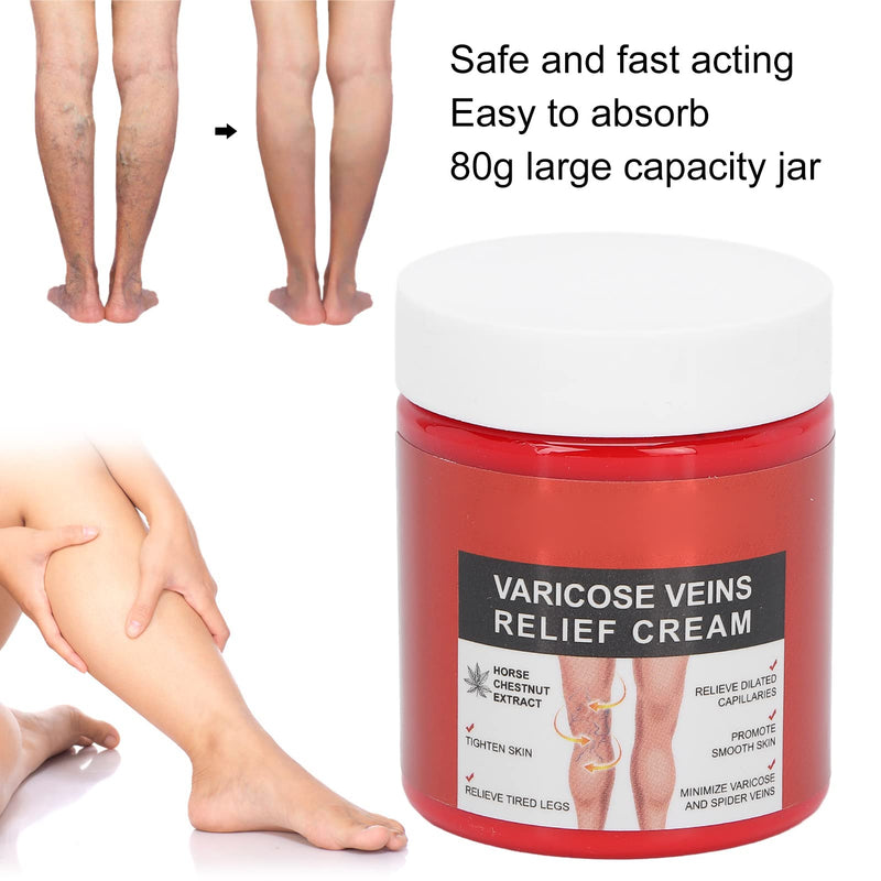 Varicose Veins Cream, Professional Varicose Vein Treatment Calf Muscle Cream, for Legs Relief Phlebitis 80g - BeesActive Australia