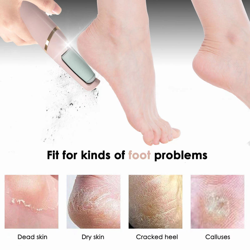 Foot File,Dongxw Electric Foot Callus Remover USB Rechargeable Waterproof Hard Skin Remover Foot with 2 Rollers LED Light,8 in 1 Foot Scraper Foot Care Gift Kit for Cracked Heels Calluses Dead Skin 1 count (Pack of 1) - BeesActive Australia