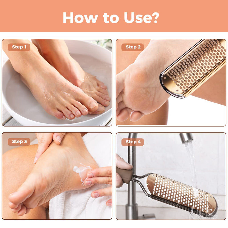 Easkep Foot File Foot Pedicure Tool, Stainless Steel Foot Scrubber Foot File Dead Skin Remover for Hard Skin and Dry Cracked Feet Scraper(Gold) - BeesActive Australia