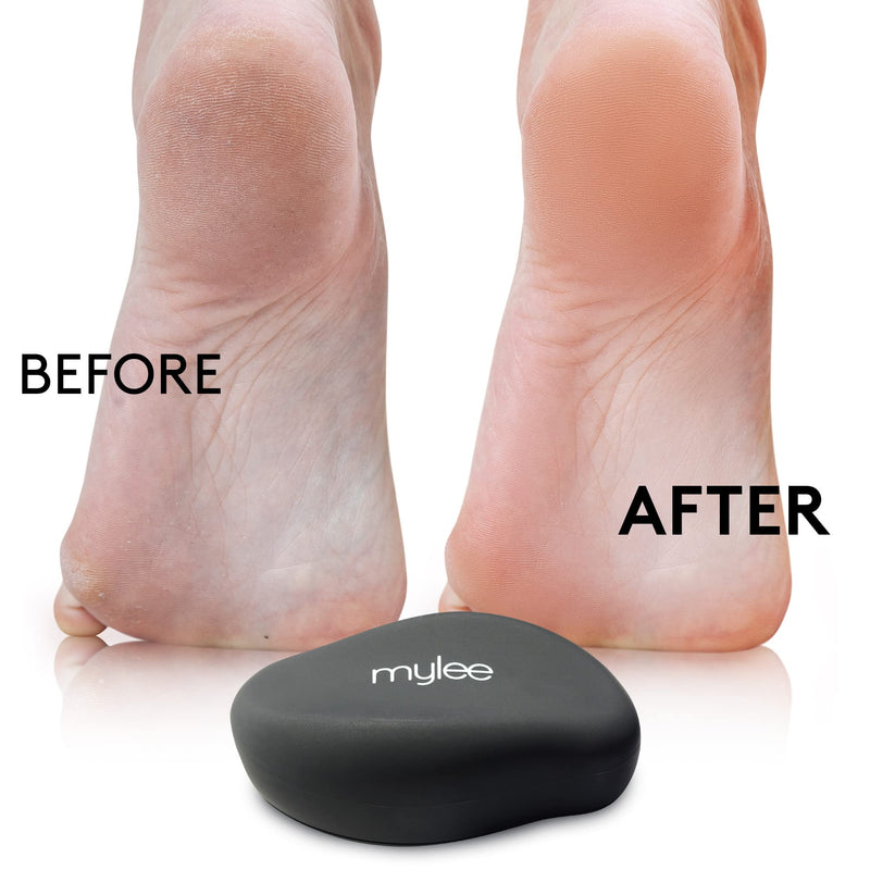 Mylee Crystal Foot File for Smooth Feet - Ultra Fine Glass Surface, Gently Removes Hard Skin, Works on Dry & Wet Feet, Easy to Clean & Sanitise Professional & Home Use, 5 Year Guarantee on the Surface - BeesActive Australia