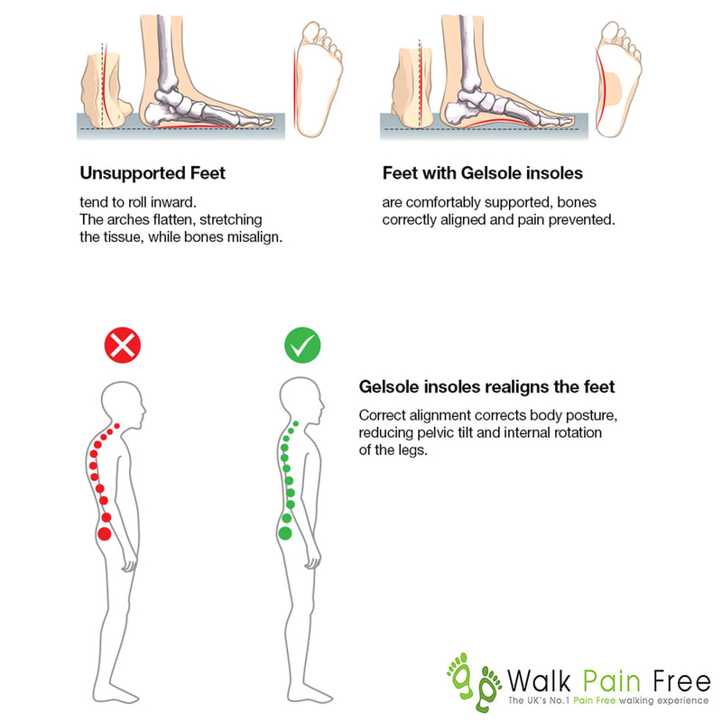 Orthotic Gel Insoles, Boost Magnetic Technology | Walk Pain Free Comfort Insoles | Reduce Heel Pain, Plantar Fasciitis, Flat Feet | Supplying NHS & Emergency Services (Small: 3 to 6 UK, Red) SMALL: 3 to 6 UK - BeesActive Australia