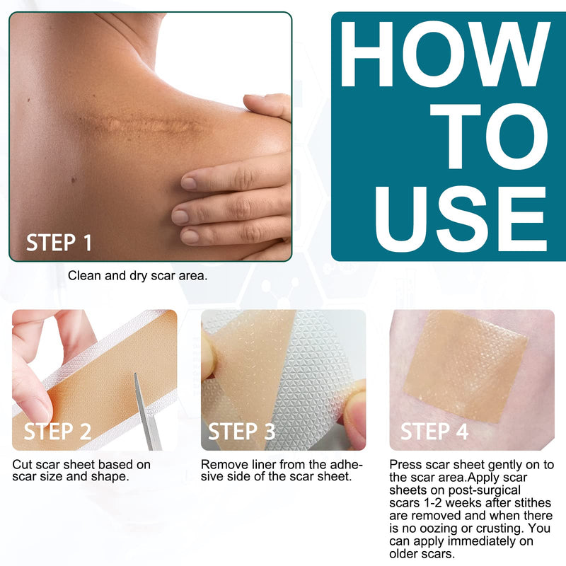 Silicone Scar Sheets (1.6” X 125”), Silicone Scar Tape Roll, Medical Grade Scar Removal Sheets for Keloid Scar Treatment, Old Scars, C-Section, Tummy Tuck, Reusable & Strong Adhesion, Waterproof One Size - BeesActive Australia