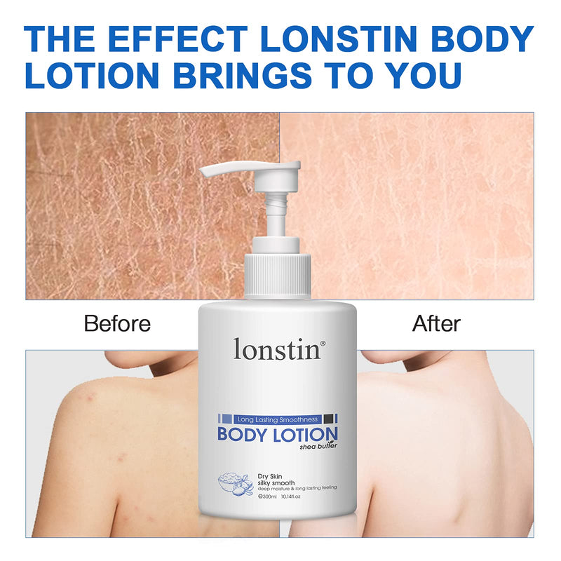 Body Lotion, lonstin Body Moisturiser with Shea Butter for Dry, Sensitive, Scratchy, Itchy Skin for Women & Men - Intensive Hydrating & Smooth Skin (300ml) 300ml - BeesActive Australia