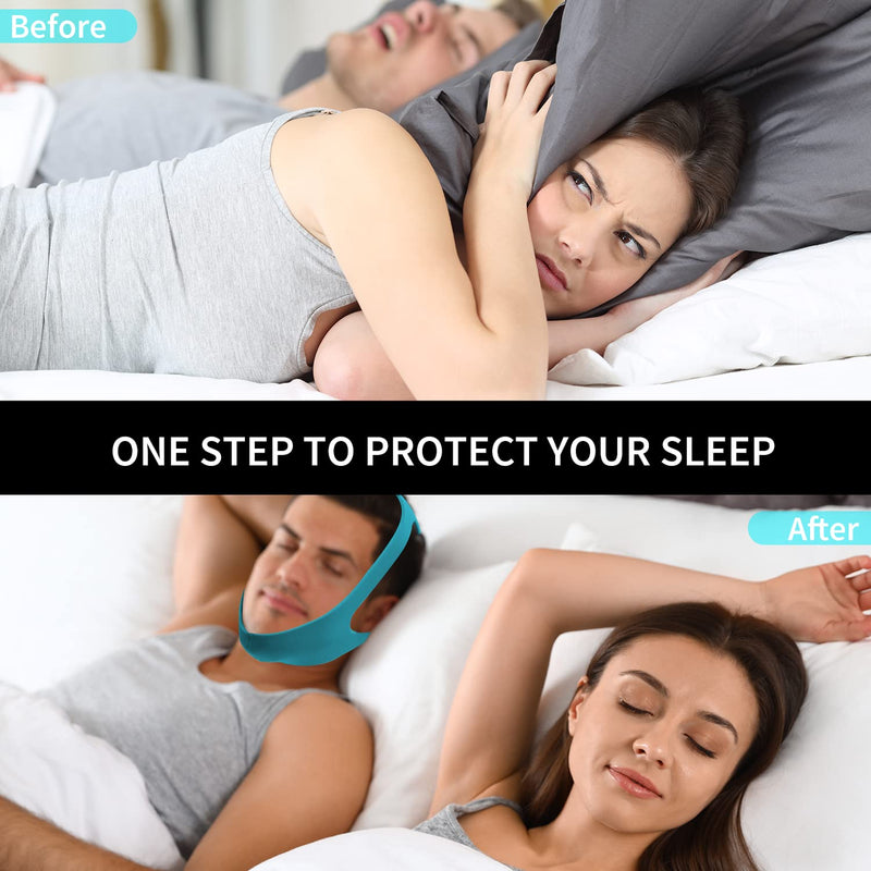Babyfond Upgrade Anti Snore Chin Strap, Larger Jaw Support Belt for CPAP Users Prevent Snoring, Adjustable and Breathable Stop Snoring Sleep Aid for Men Women (Blue) Blue - BeesActive Australia