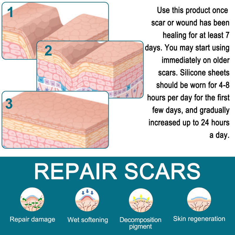 Silicone Scar Sheets (1.6” X 125”), Silicone Scar Tape Roll, Medical Grade Scar Removal Sheets for Keloid Scar Treatment, Old Scars, C-Section, Tummy Tuck, Reusable & Strong Adhesion, Waterproof One Size - BeesActive Australia
