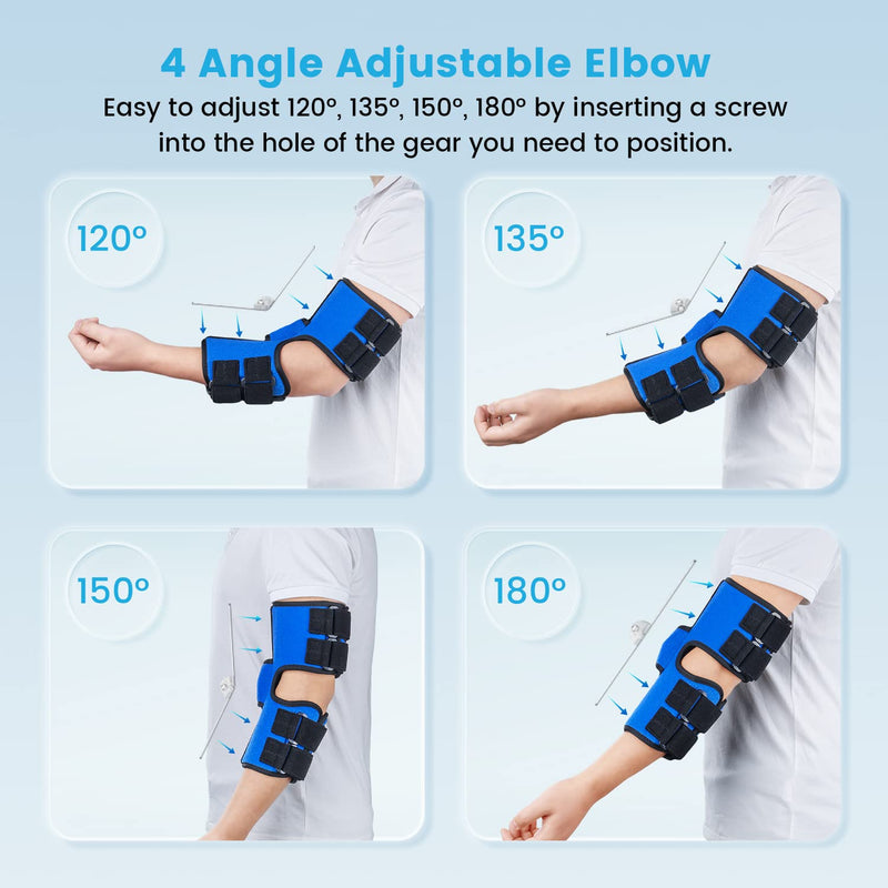 Elbow Splint, Elbow Brace for Cubital Tunnel Syndrome and Ulnar Nerve Entrapment,New Upgraded with 4 Angles Adjustable,Fixed Elbow,Prevent Excessive Bending,for Men,Women,fits Left and Right Arm -S/M S/M - BeesActive Australia