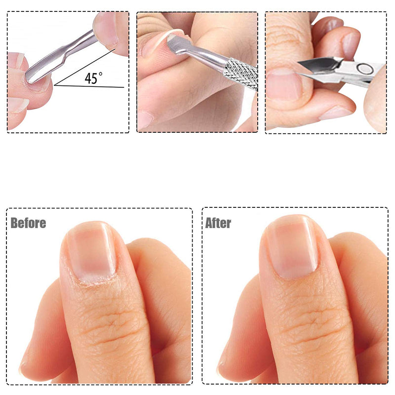 Cuticle Trimmer with Cuticle Pusher - Cuticle Remover Cuticle Nipper Professional Stainless Steel Cuticle Cutter Clipper Durable Pedicure Manicure Tools for Fingernails and Toenails (Silver) - BeesActive Australia