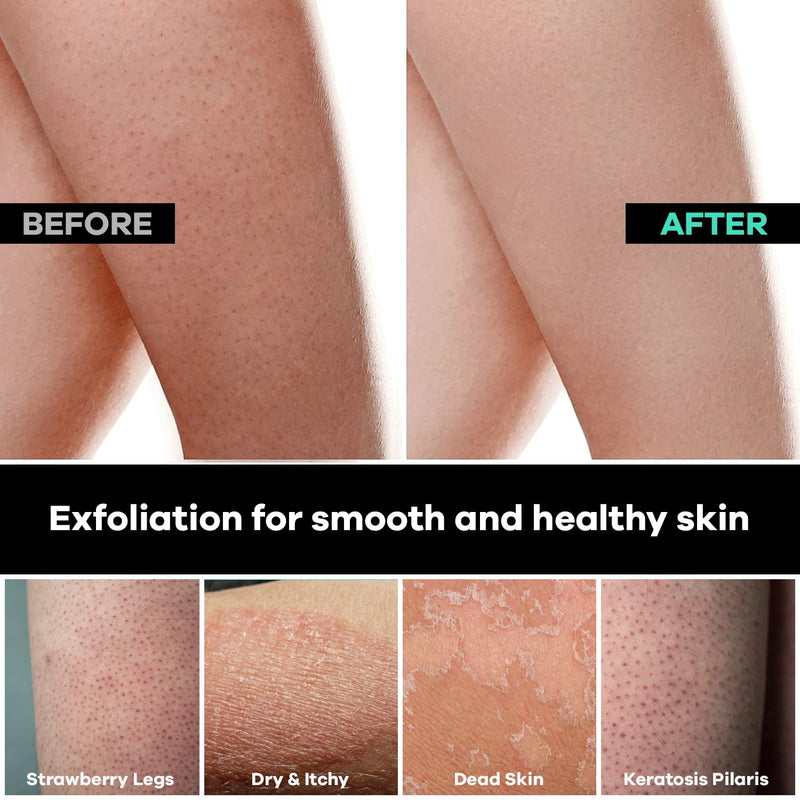 Dermasuri Deep Exfoliating Mitt Body Scrub - Body Scrubber & Skin Cleanser for Women & Men - Skin Exfoliator for Body Tool Remover of Dead & Dry Skin Single Pack - BeesActive Australia