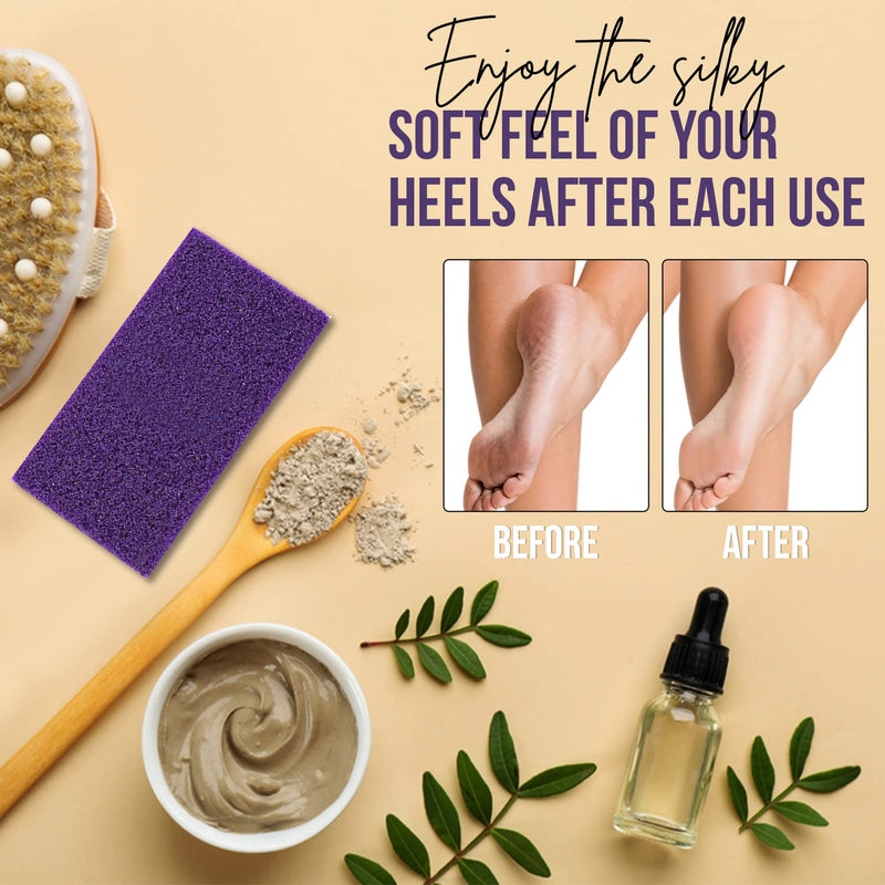 Glamza Foot Pumice Sponge Callus Exfoliate Stone Hard Skin Remove Pedicure Scrubber Pack of 4 - BeesActive Australia