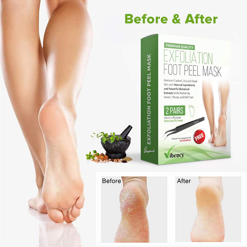 Exfoliation Foot Peel Masks (2-Pairs) Natural Botanical In-Home Spa Treatment | Feet Peeling, Dead Skin Remover, Exfoliating Booties | Relieve Dry, Cracked Irritation | Incl. Tweezers - BeesActive Australia
