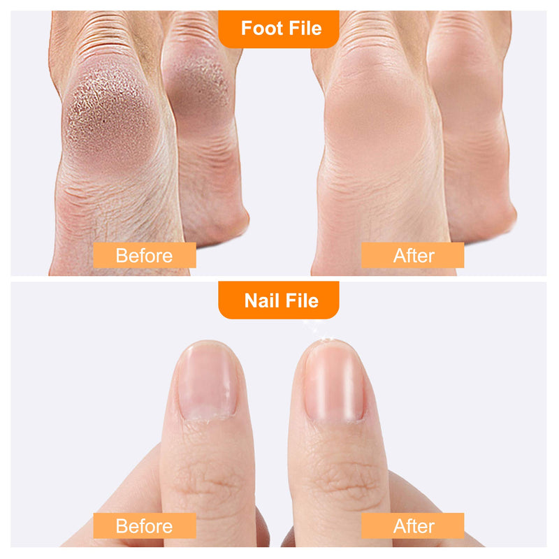 Foot Pedicure Scrubber Callus Remover - Professional feet care and Nail Files - Nano-Level Grinding Points,Dead Skin Removal - Wet,Dry and Cracking Feet - BeesActive Australia