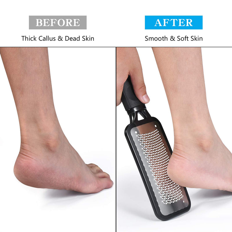 NuLink Callus Remover File Tool, Colossal Foot Rasp, Foot Scrubber, Heel Scraper, Pedicure Exfoliator to Remove Dead Hard Skin, Medical Stainless Steel Grade Works Both Dry, Wet Foot Feet - BeesActive Australia