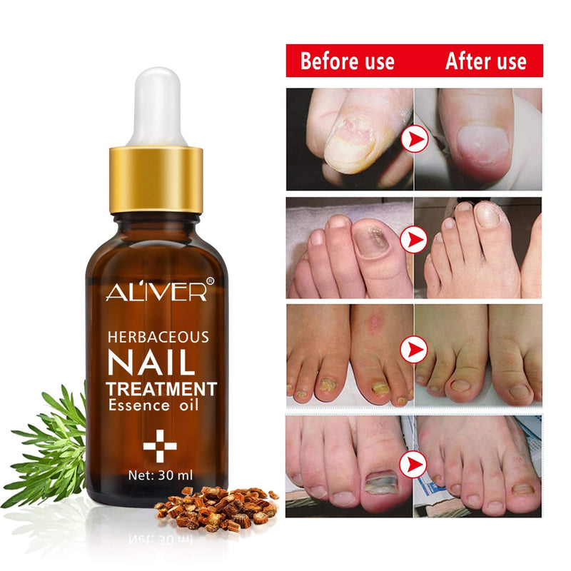 Nail Treatment Essence Oil, Natural Nail Treatment, Effective Nail Repair cream, Use for Toenails and Fingernails Solution - BeesActive Australia