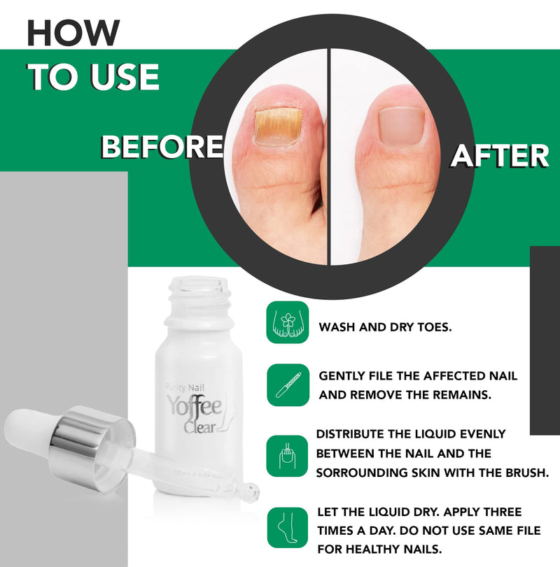 Yoffee Clear Nail Care - Anti Fungal Nail Treatment for Finger and Toenails - 10 ml - Antibacterial and Antiseptic - Fungal with Organic Argan Oil and Tea Tree Oil - Concentrated Formula/Made in Spain 10 ml (Pack of 1) - BeesActive Australia