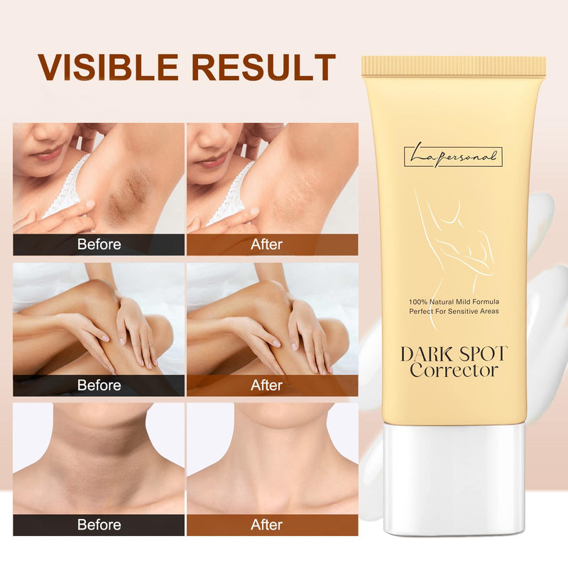 LA.PERSONAL Dark Spot Corrector for Body, Underarm, Dark Spot Corrector Cream Targets Knees, Elbows, Private Bikini Line, Inner Thigh, Moisturizes Body Butt Back Cream for Women and Men (2.14oz) - BeesActive Australia