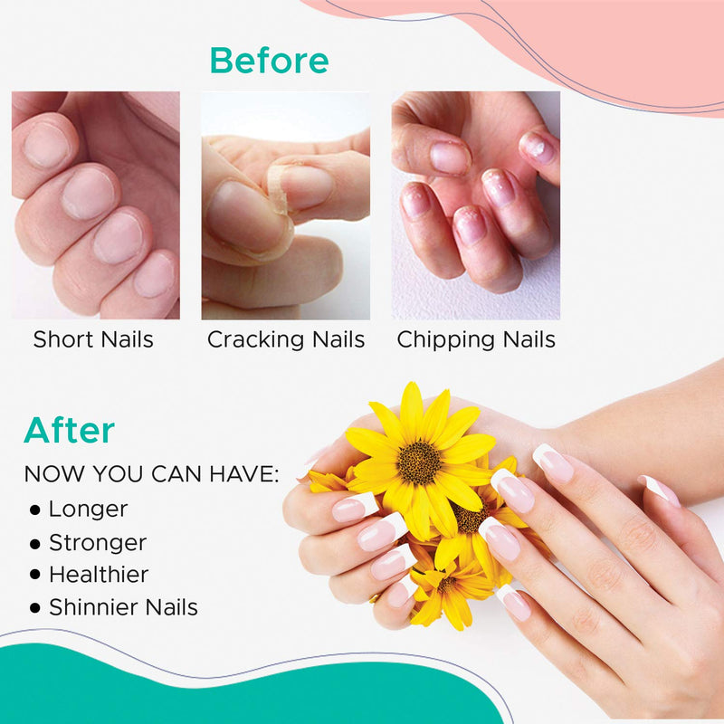 Karlash Nail Strengthener for Weak, Damaged Nails, Promotes Growth and Restores thin, cracking, and peeling nails .5 fl oz/ 15 mL, Use as a Nail Strengthener or Top Coat or Base Coat. (1 Piece) 1 Piece - BeesActive Australia