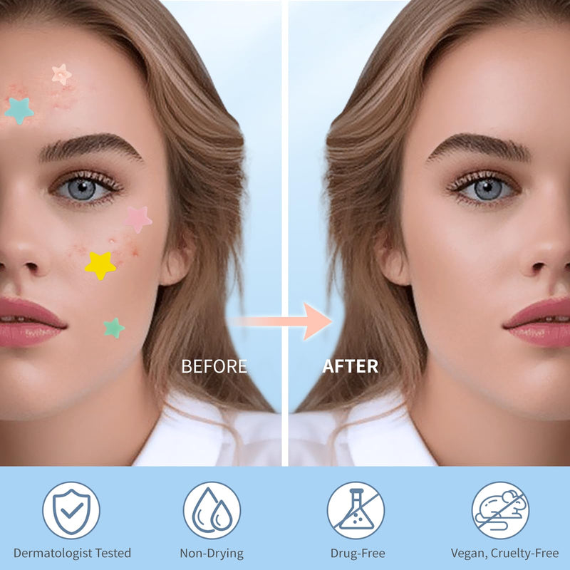 QUSTERE Pimple Patches for Face, Hydrocolloid Acne Patches, Cute Star Zit Covers, Colorful Spot Stickers with Tea Tree, Salicylic Acid & Cica Oil| 3 Sizes (10mm, 12mm & 14mm) |200 Count 200pcs - BeesActive Australia
