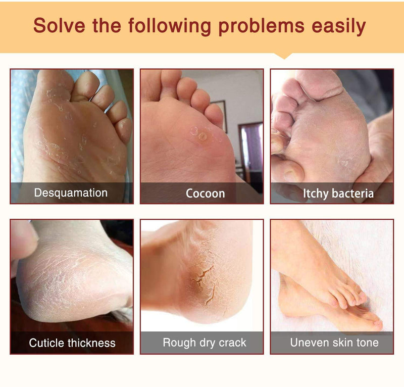 Foot Peel Mask, 3 Pack Lavender Foot Mask,Exfoliating Socks Remove Hard Skin, Calluses,Dead and Dry Skin,Repair Rough Heels in 7 Days - BeesActive Australia