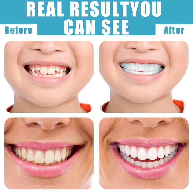 Fake Teeth Temporary Denture Teeth Veneer Snap in Teeth Confidence Smile Dentures Veneers Fake White Teeth with Mini Tweezers for Men and Women Bad Teeth Whitening Alternative (4 Pieces) - BeesActive Australia