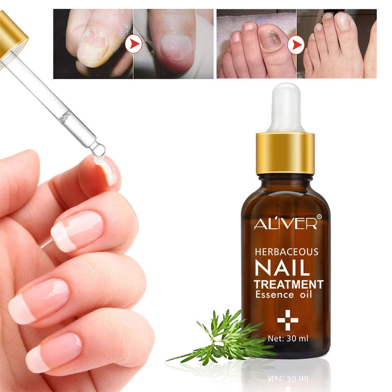 Nail Treatment Essence Oil, Natural Nail Treatment, Effective Nail Repair cream, Use for Toenails and Fingernails Solution - BeesActive Australia